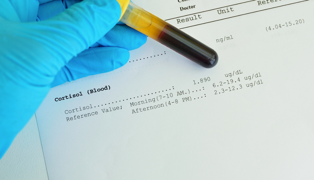 Niveles bajos de cortisol: causas, síntomas y tratamientos