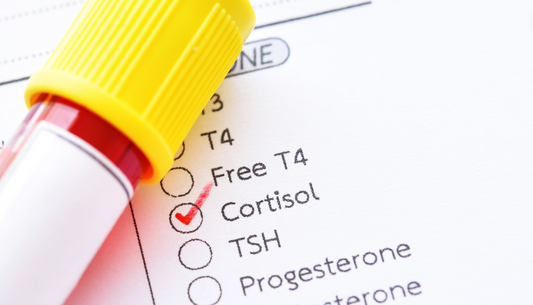 Prueba del nivel de cortisol: comprender su papel en el estrés y la salud