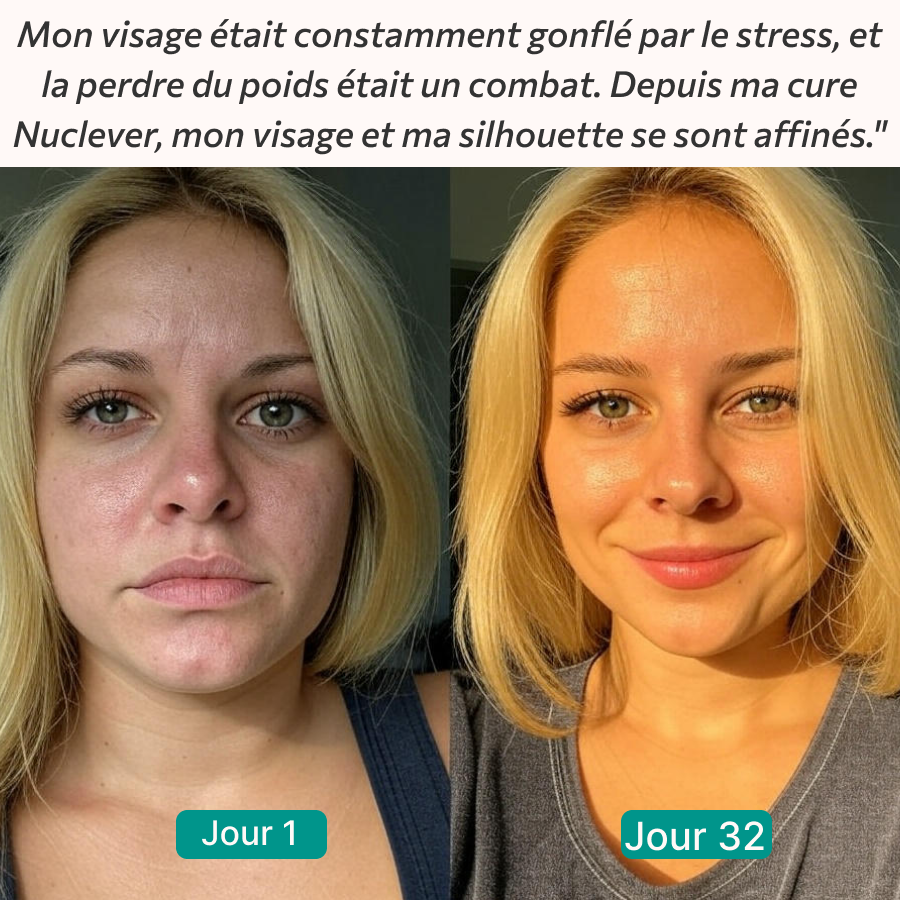 Nuclever Cortisol Manager™ Cure de 120 Jours (4 Sacs) + Accessoires gratuits